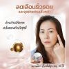 Minus20 Pink Gold ไมนัส ทเวนตี้ ครีมลดริ้วรอย (30ml) 2 กล่อง + แถมฟรี Minus20 Moisturizer Body Lotion 2 หลอด