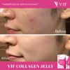 Vif Collagen Jelly วีฟ คอลลาเจน เจลลี่ (10 ซอง) 1 กล่อง + แถมฟรี Vif Collagen Jelly วีฟ คอลลาเจน เจลลี่ (10 ซอง) 1 กล่อง