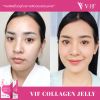 Vif Collagen Jelly วีฟ คอลลาเจน เจลลี่ (10 ซอง) 1 กล่อง + แถมฟรี Vif Collagen Jelly วีฟ คอลลาเจน เจลลี่ (10 ซอง) 1 กล่อง
