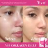 Vif Collagen Jelly วีฟ คอลลาเจน เจลลี่ (10 ซอง) 1 กล่อง + แถมฟรี Vif Collagen Jelly วีฟ คอลลาเจน เจลลี่ (10 ซอง) 1 กล่อง