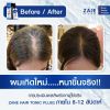 Zane Hair Tonic Plus 2 เซน แฮร์ โทนิค พลัส ทู (75ml ) 2 กล่อง