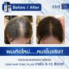 Zane Hair Tonic Plus 2 เซนแฮร์โทนิคพลัสทู ปลูกผม (75ml ) 1 กล่อง + Micellar Shampoo แชมพู (200ml) 1 กล่อง + Hair Treatment (200ml.) 1 หลอด + ผ้าคลุมผมนาโน 1 ผืน
