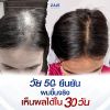 Zane Hair Tonic Plus 2 เซน แฮร์ โทนิค พลัส ทู (75ml ) 3 กล่อง