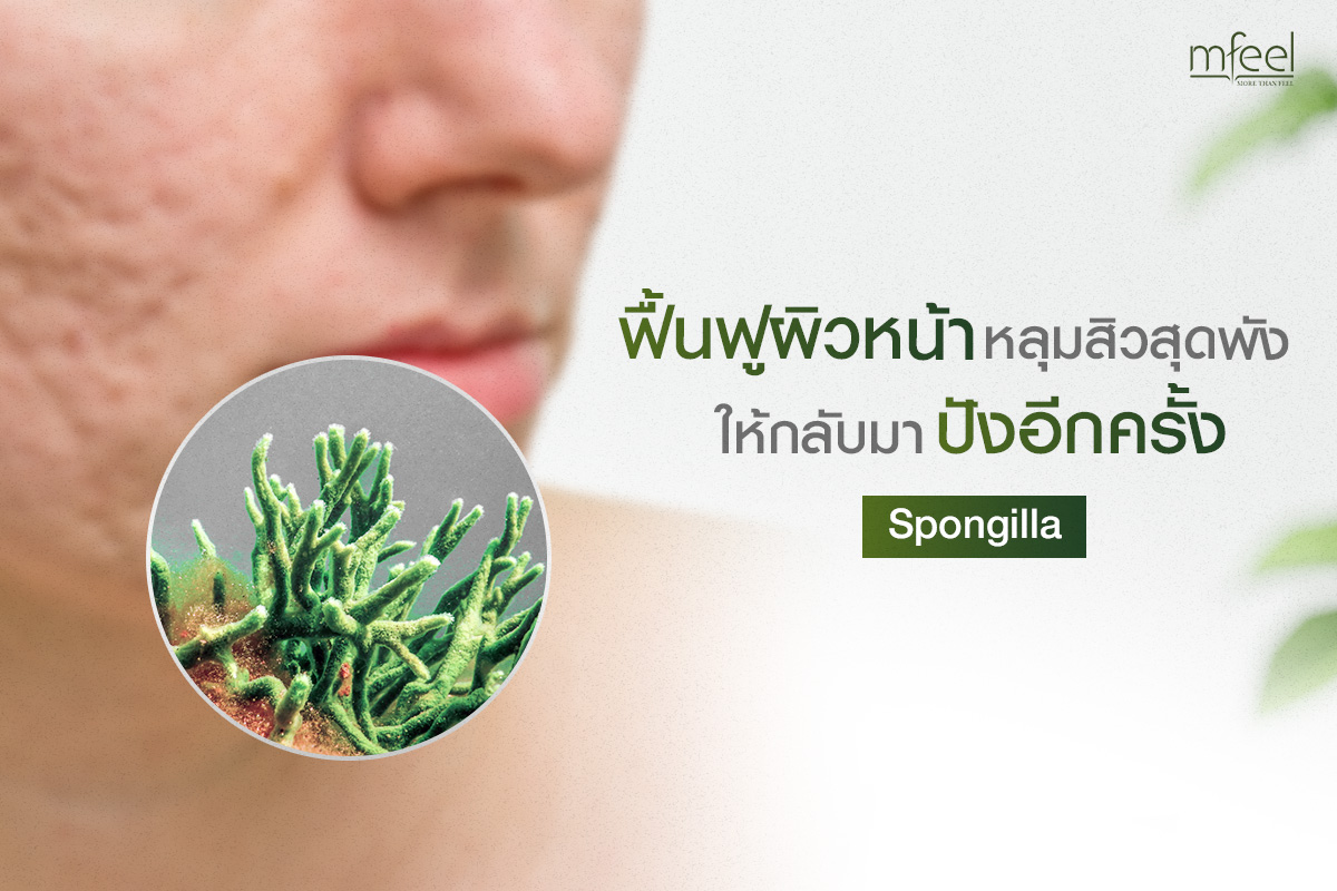 Spongilla ฟื้นฟูผิวหน้าหลุมสิวสุดพัง ให้กลับมาปังอีกครั้ง