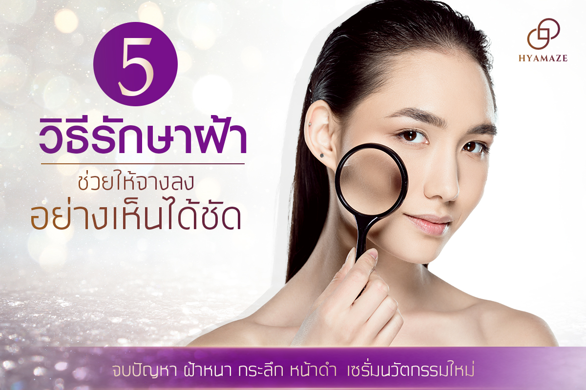 5 วิธีรักษาฝ้า ช่วยให้จางลงอย่างเห็นได้ชัด