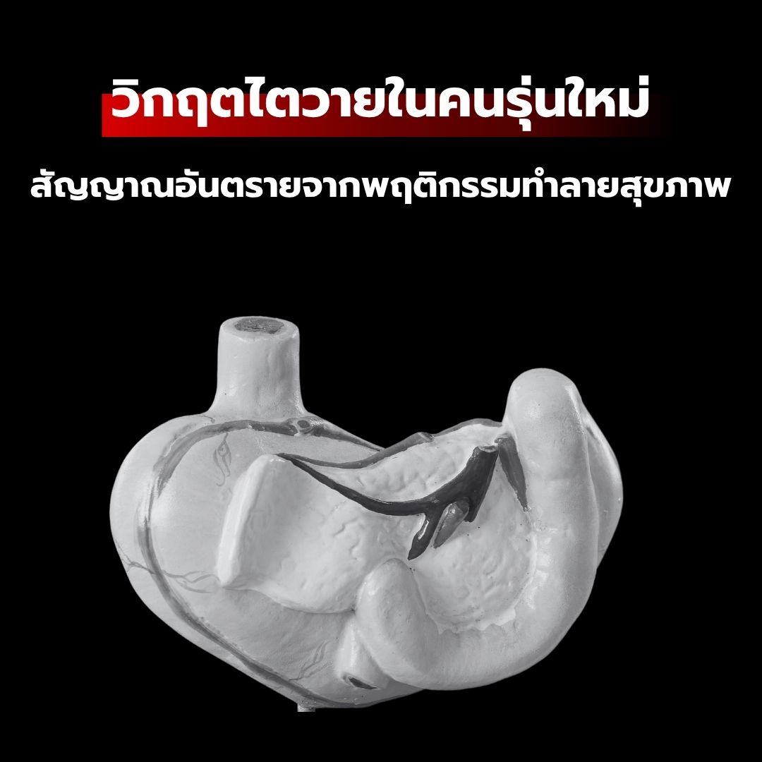 วิกฤตไตวายในคนรุ่นใหม่ : สัญญาณอันตรายจากพฤติกรรมทำลายสุขภาพ