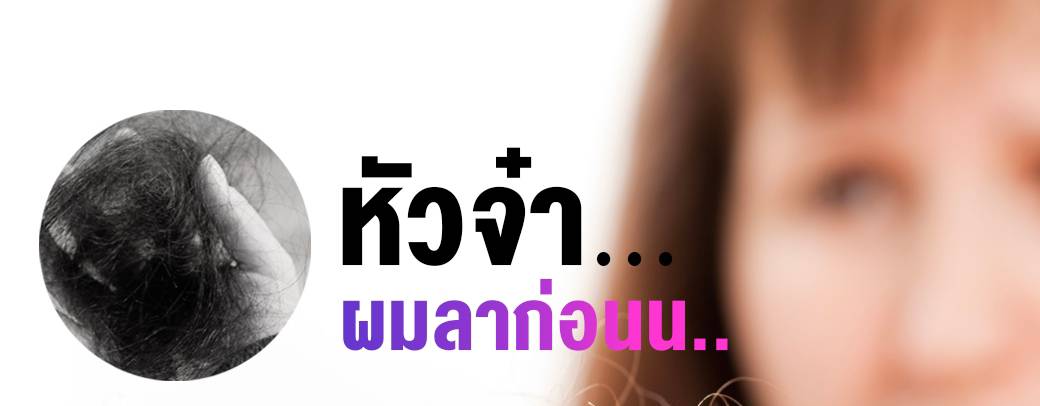 หัวจ๋า...ผมลาก่อน ผมร่วง ผมบาง ศีรษะล้าน