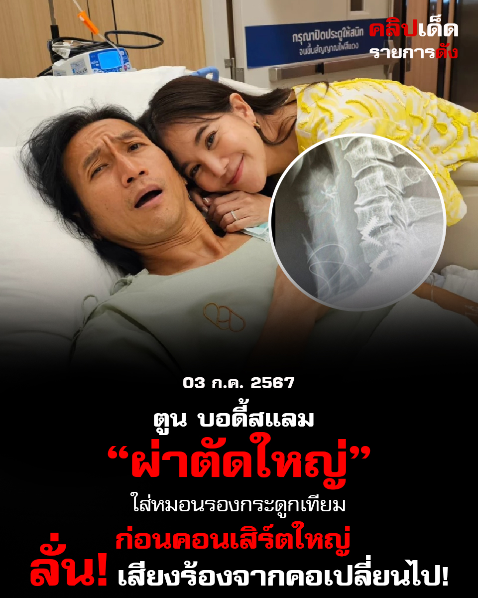 "ตูน บอดี้สแลม ผ่าตัดใส่หมอนรองกระดูกเทียม ก่อนคอนเสิร์ตใหญ่ ลั่น! เสียงร้องจากคอเปลี่ยนไป!"