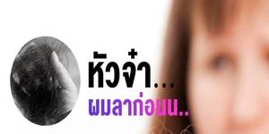 หัวจ๋า...ผมลาก่อน ผมร่วง ผมบาง ศีรษะล้าน